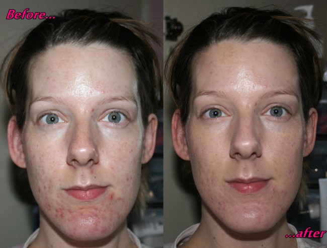 Benefit Oxygen Wow Before and After