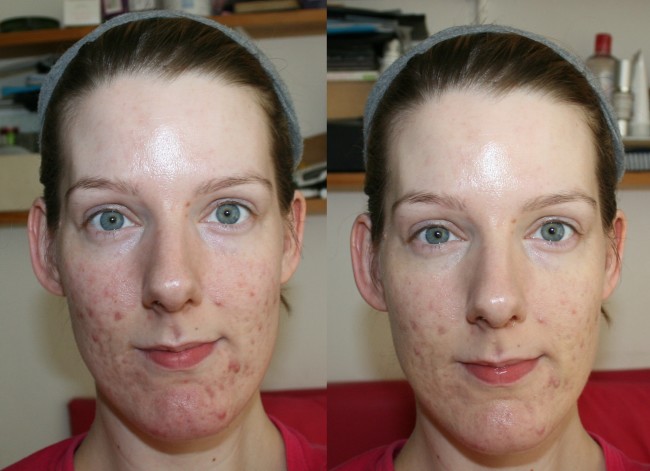 BareMinerals Neutralizing Foundation Primer before and after