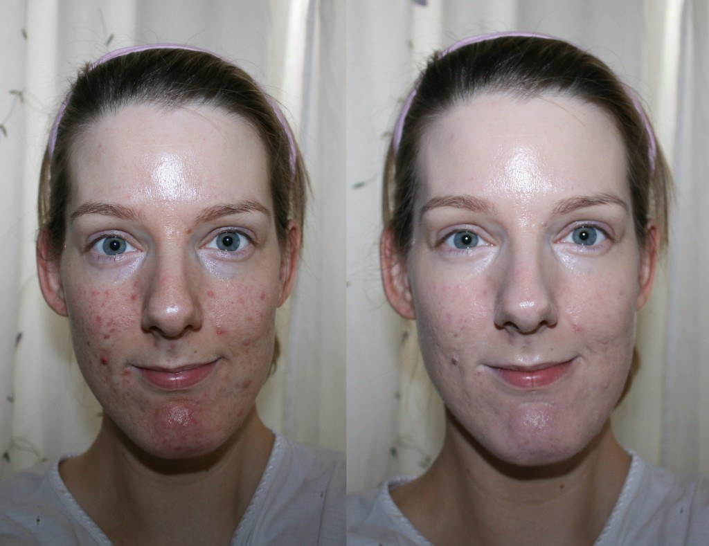 laneige-pore-control-bb-cushion-foundation-before-and-after-beauty