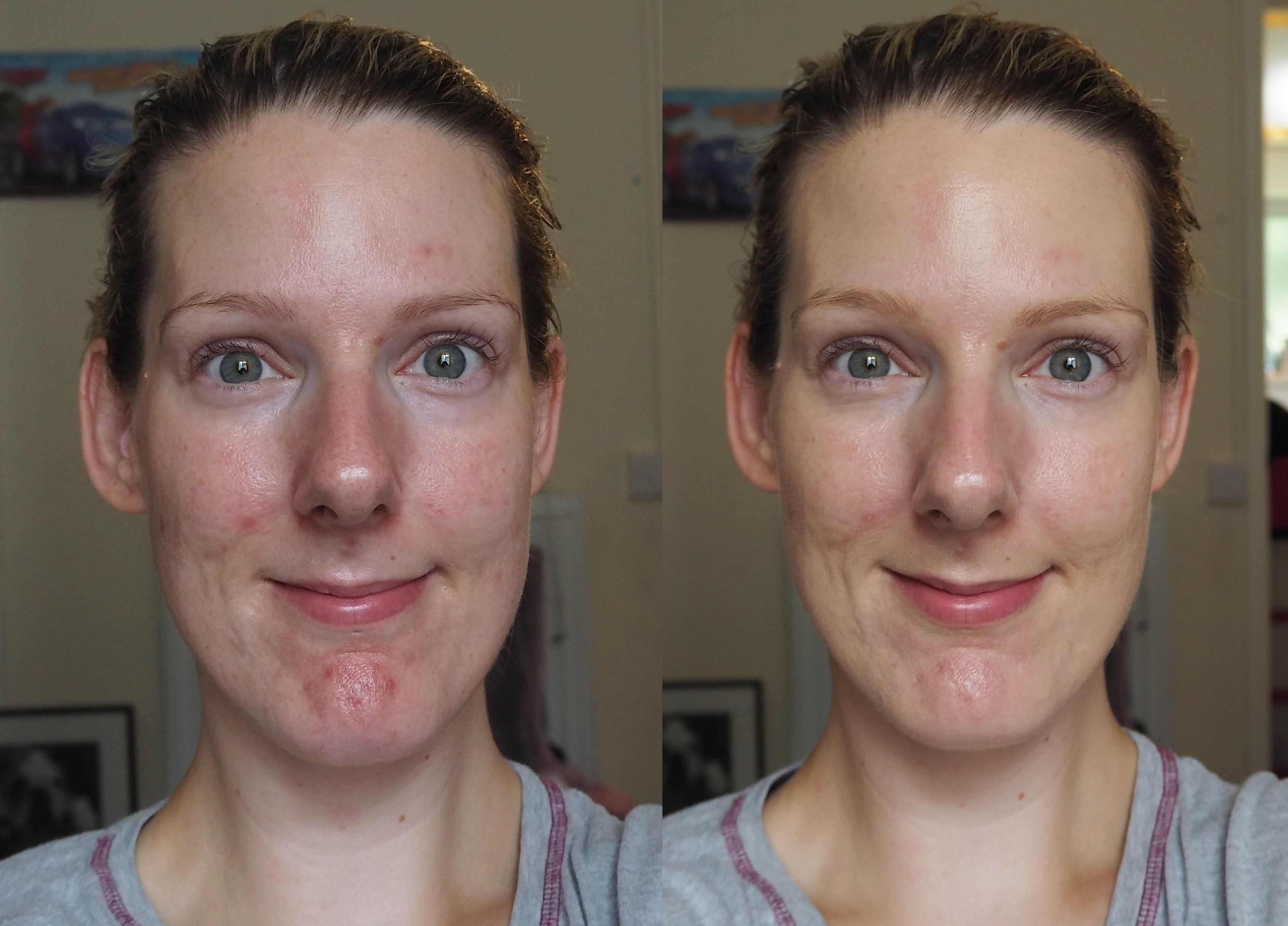 Revlon Photoready Candid Foundation before and after face pictures