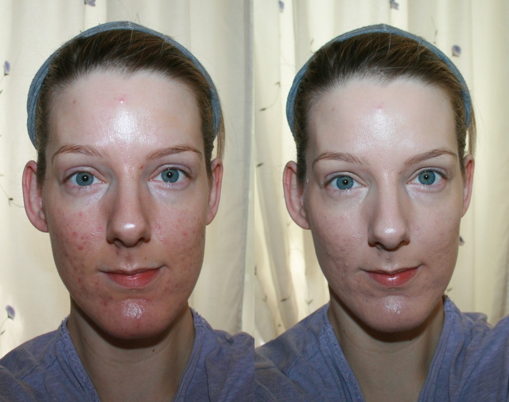 Clarins Everlasting Foundation+ Before and After - Beauty Geek UK